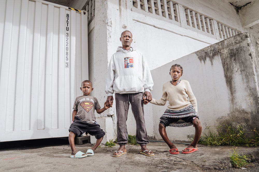 Arla and Elidiot's father asked that a photo be taken of the two before and after surgery, showing just how far his children had come.