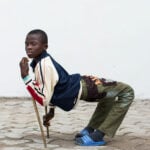 mercy-ships-patient-stories-ulrich-ortho-hero-image