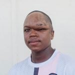 mercy-ships-patient-stories-diongnima-hero-image