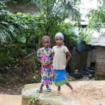mercy-ships-patient-stories-salamatou-mariama-ortho-before