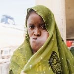 mercy-ships-patient-story-diarra-feature