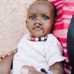mercy-ships-blog-patient-stories-mame-diarra-feature