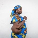 mercy-ships-blog-patient-stories-feature