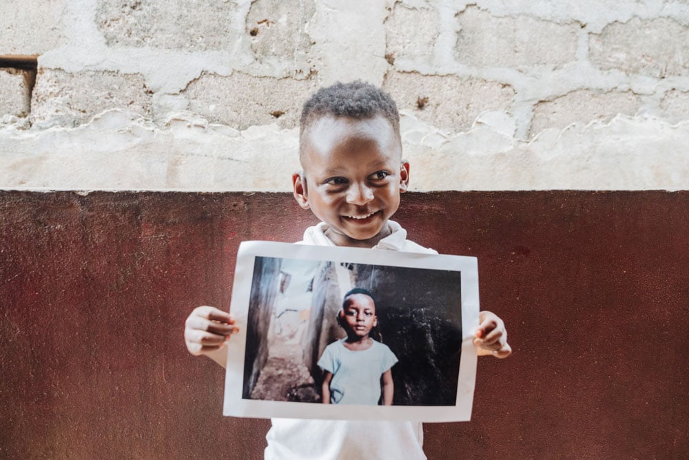 mercy-ships-blog-patient-story-emmanuel-4