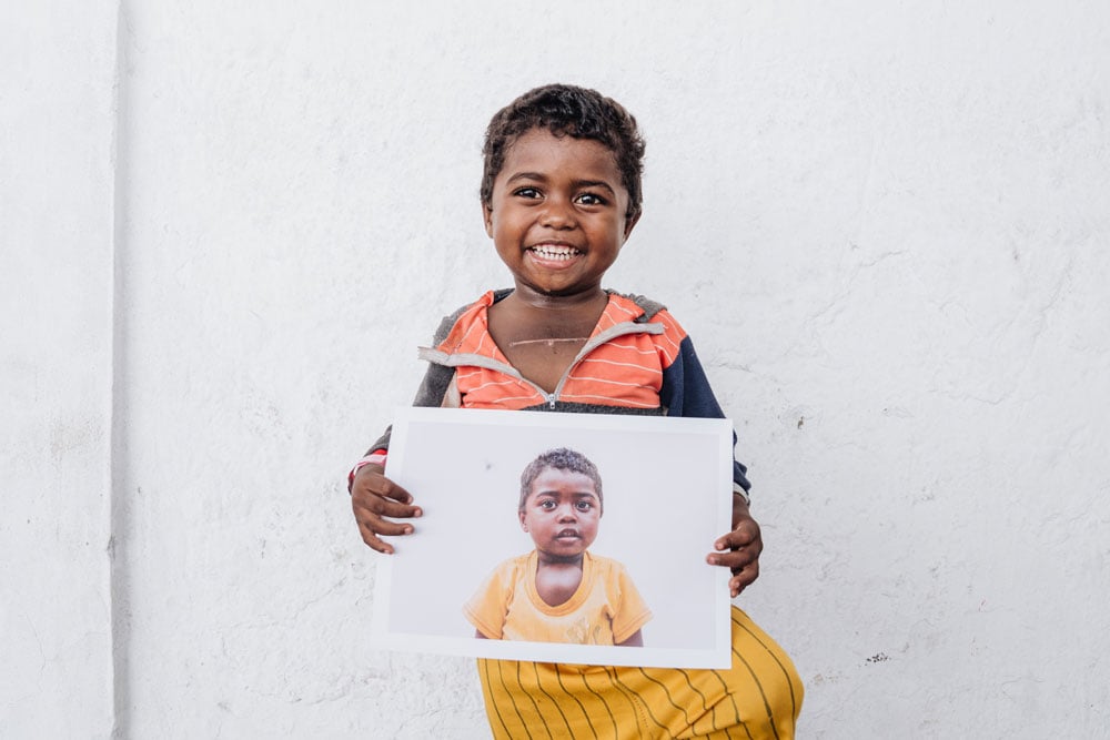 Meet Danielo - Mercy Ships