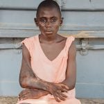 mercy-ships-patient-stories-david-sierra-leone-feature