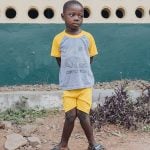 Amara struggled from knock-knee, keeping him from walking without pain.
