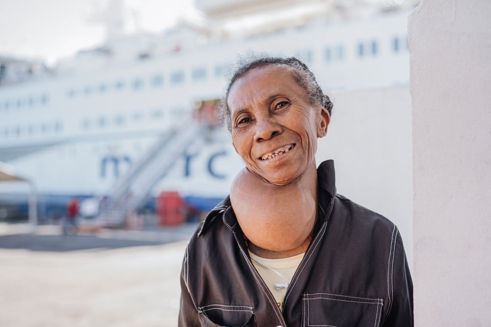Vaviroa struggled with a goiter for more than 10 years.