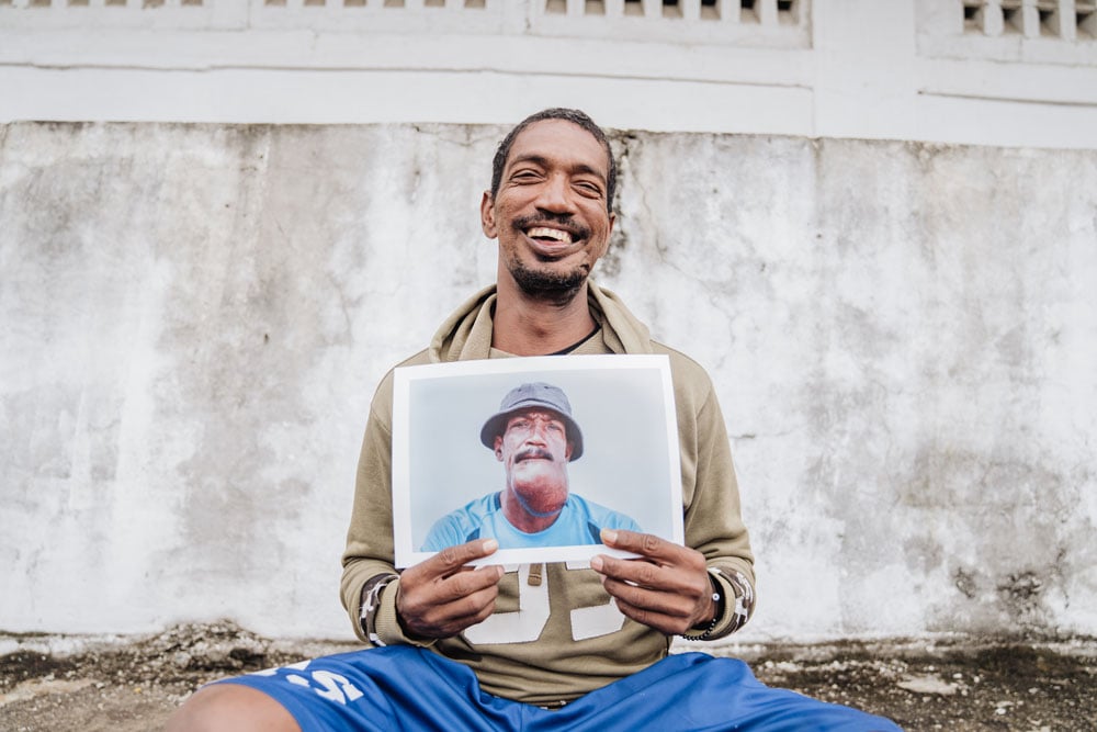 Thierry found healing on board the Africa Mercy.