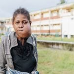 Theogette struggled with a tumor on her jaw for over 10 years.
