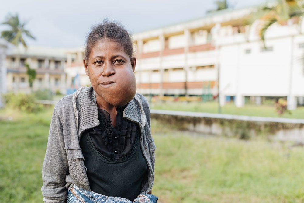 Theogette struggled with a tumor on her jaw for over 10 years.