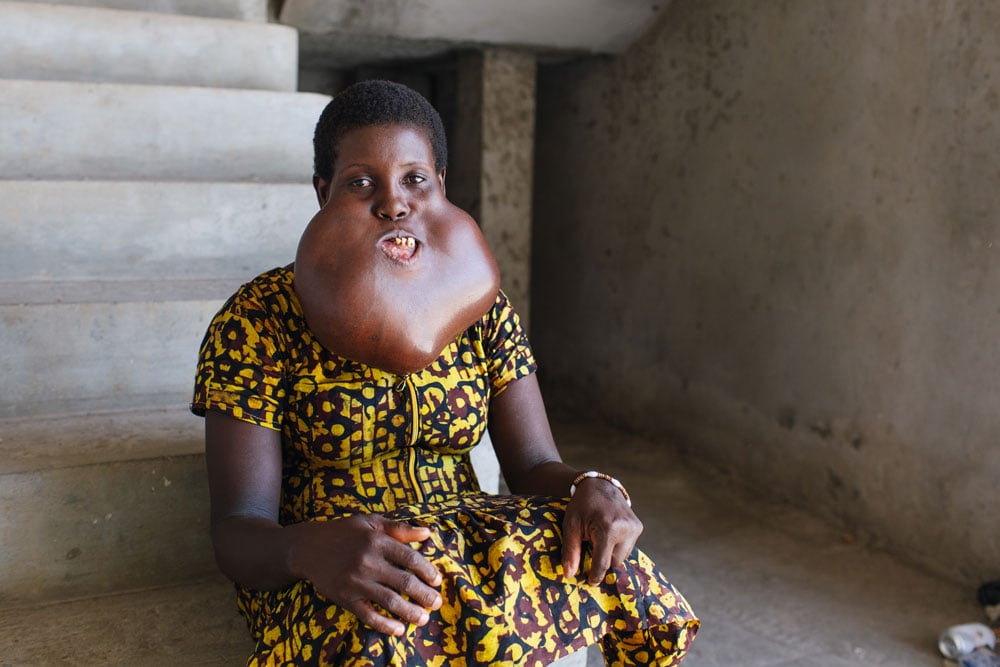A large tumor had taken over Charity's life. Surgery changed her future.