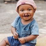 Alfredo found healing with Mercy Ships.