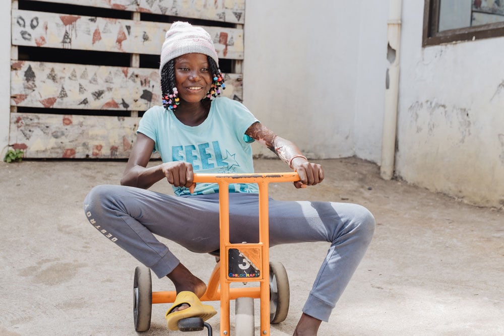 Surgery aboard the Global Mercy released the strain of the scars on her arm.